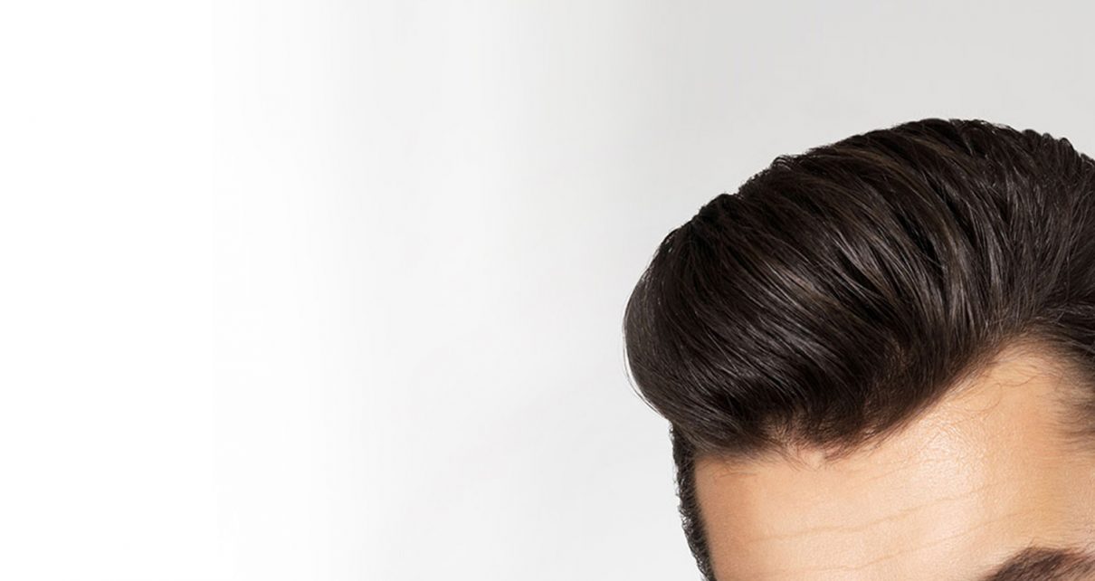 Top 5 Celebrities Who Have Had Hair Transplants