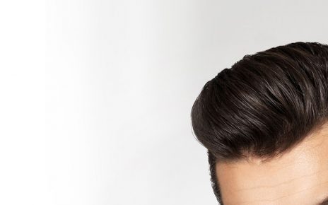 Top 5 Celebrities Who Have Had Hair Transplants