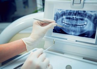 Dental Imaging Technology Market