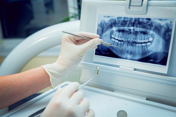 Dental Imaging Technology Market
