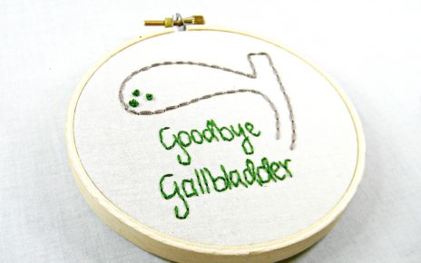 gall bladder stone treatment