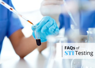 STI Testing Faqs