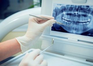 Dental Imaging Market
