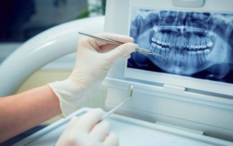 Dental Imaging Market