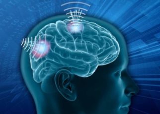 Wireless Brain Sensors Market