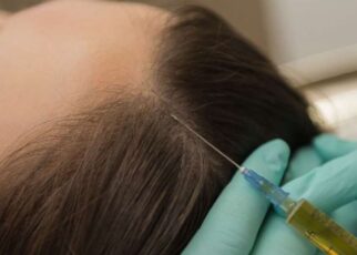hair loss treatment Ludhiana.