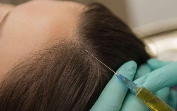 hair loss treatment Ludhiana.